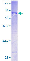 ab165618 on a 12.5% SDS-PAGE stained with Coomassie Blue.