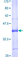 ab165212 on a 12.5% SDS-PAGE stained with Coomassie Blue.