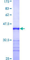 ab158073 on a 12.5% SDS-PAGE stained with Coomassie Blue.