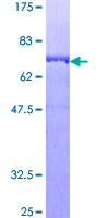 ab153408 on a 12.5% SDS-PAGE stained with Coomassie Blue.