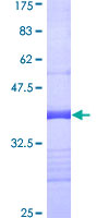 ab153409 on a 12.5% SDS-PAGE stained with Coomassie Blue.