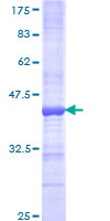 ab163282 on a 12.5% SDS-PAGE stained with Coomassie Blue.