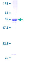 ab161559 on a 12.5% SDS-PAGE stained with Coomassie Blue.