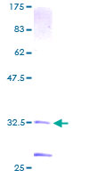 ab159604 on a 12.5% SDS-PAGE stained with Coomassie Blue.