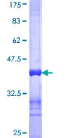 ab159605 on a 12.5% SDS-PAGE stained with Coomassie Blue.