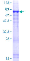 ab165793 on a 12.5% SDS-PAGE stained with Coomassie Blue.