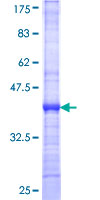 ab165794 on a 12.5% SDS-PAGE stained with Coomassie Blue.