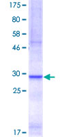 ab159522 on a 12.5% SDS-PAGE stained with Coomassie Blue.