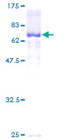 ab162436 on a 12.5% SDS-PAGE stained with Coomassie Blue.