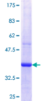 ab160155 on a 12.5% SDS-PAGE stained with Coomassie Blue.