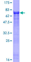 ab160654 on a 12.5% SDS-PAGE stained with Coomassie Blue.