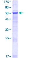 ab163370 on a 12.5% SDS-PAGE stained with Coomassie Blue.