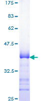 ab153292 on a 12.5% SDS-PAGE stained with Coomassie Blue.