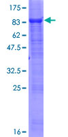 ab153542 on a 12.5% SDS-PAGE stained with Coomassie Blue.