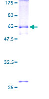 ab162716 on a 12.5% SDS-PAGE stained with Coomassie Blue.