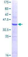 ab159505 on a 12.5% SDS-PAGE stained with Coomassie Blue.