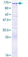ab161979 on a 12.5% SDS-PAGE stained with Coomassie Blue.