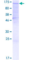 ab160931 on a 12.5% SDS-PAGE stained with Coomassie Blue.