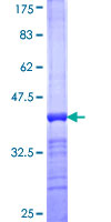 ab160932 on a 12.5% SDS-PAGE stained with Coomassie Blue.