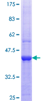 ab153230 on a 12.5% SDS-PAGE stained with Coomassie Blue.