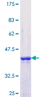 ab160910 on a 12.5% SDS-PAGE stained with Coomassie Blue.