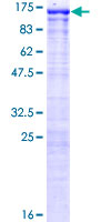 ab153352 on a 12.5% SDS-PAGE stained with Coomassie Blue.