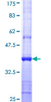 ab153353 on a 12.5% SDS-PAGE stained with Coomassie Blue.