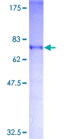ab159972 on a 12.5% SDS-PAGE stained with Coomassie Blue.