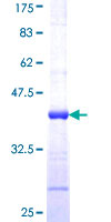 ab159973 on a 12.5% SDS-PAGE stained with Coomassie Blue.