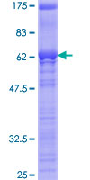 ab159497 on a 12.5% SDS-PAGE stained with Coomassie Blue.