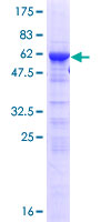ab159498 on a 12.5% SDS-PAGE stained with Coomassie Blue.