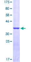 ab166583 on a 12.5% SDS-PAGE stained with Coomassie Blue.