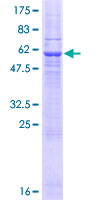 ab164962 on a 12.5% SDS-PAGE stained with Coomassie Blue.