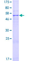 ab165152 on a 12.5% SDS-PAGE stained with Coomassie Blue.