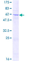ab164373 on a 12.5% SDS-PAGE stained with Coomassie Blue.