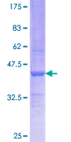 ab164374 on a 12.5% SDS-PAGE stained with Coomassie Blue.