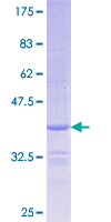 ab164375 on a 12.5% SDS-PAGE stained with Coomassie Blue.