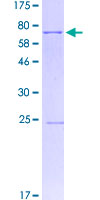 ab160261 on a 12.5% SDS-PAGE stained with Coomassie Blue.