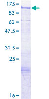 ab164536 on a 12.5% SDS-PAGE stained with Coomassie Blue.