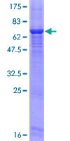 ab164520 on a 12.5% SDS-PAGE stained with Coomassie Blue.