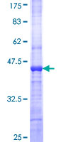 ab164521 on a 12.5% SDS-PAGE stained with Coomassie Blue.