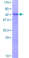 ab160823 on a 12.5% SDS-PAGE stained with Coomassie Blue.