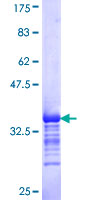ab160824 on a 12.5% SDS-PAGE stained with Coomassie Blue.