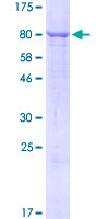 ab160241 on a 12.5% SDS-PAGE stained with Coomassie Blue.