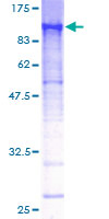 ab161413 on a 12.5% SDS-PAGE stained with Coomassie Blue.