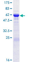 ab162785 on a 12.5% SDS-PAGE stained with Coomassie Blue.