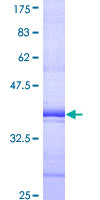 ab163751 on a 12.5% SDS-PAGE stained with Coomassie Blue.