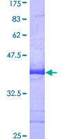 ab159503 on a 12.5% SDS-PAGE stained with Coomassie Blue.