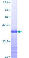 ab161745 on a 12.5% SDS-PAGE stained with Coomassie Blue.