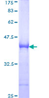ab160499 on a 12.5% SDS-PAGE stained with Coomassie Blue.